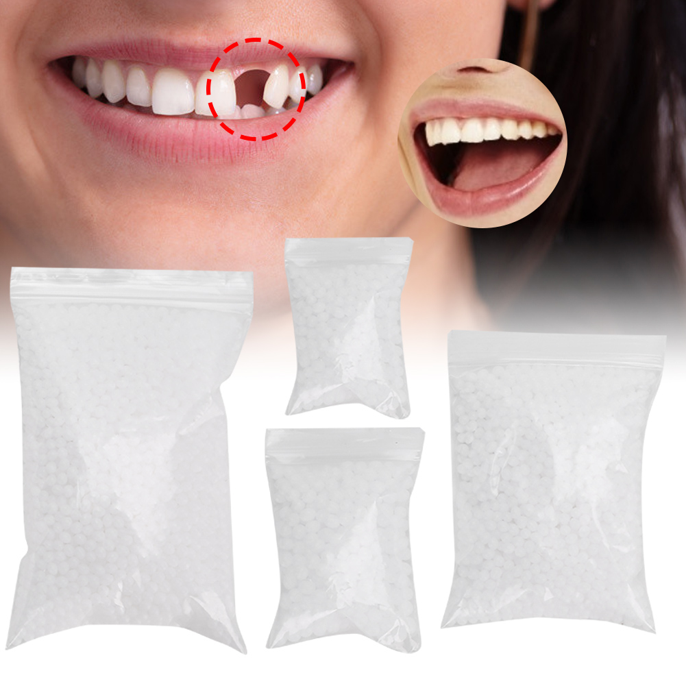 Teeth Whitening Moulds - Diş Tamir Boncukları Kırık Dişlerin Onarımı
