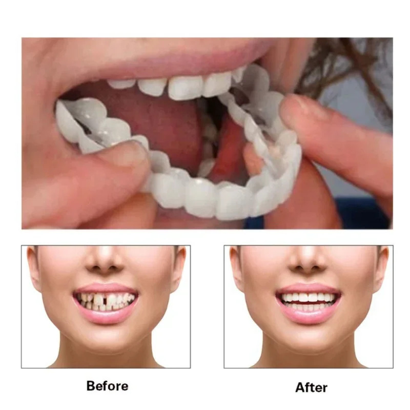 Teeth Whitening Moulds - Mükemmel Uyumlu Diş Beyazlatıcı Takma Diş