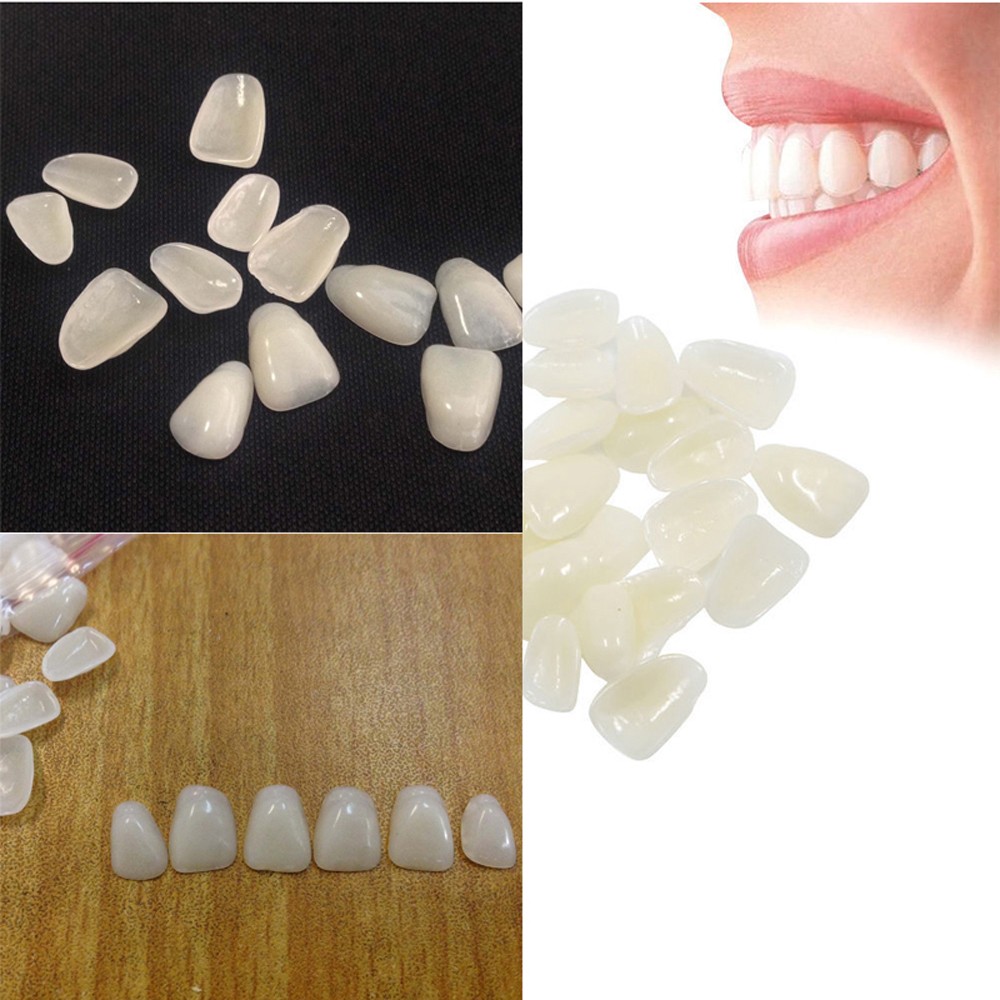Teeth Whitening Moulds - 70 Adet/Paket Güzellik Kaplamaları Beyazlatıcı Ultra