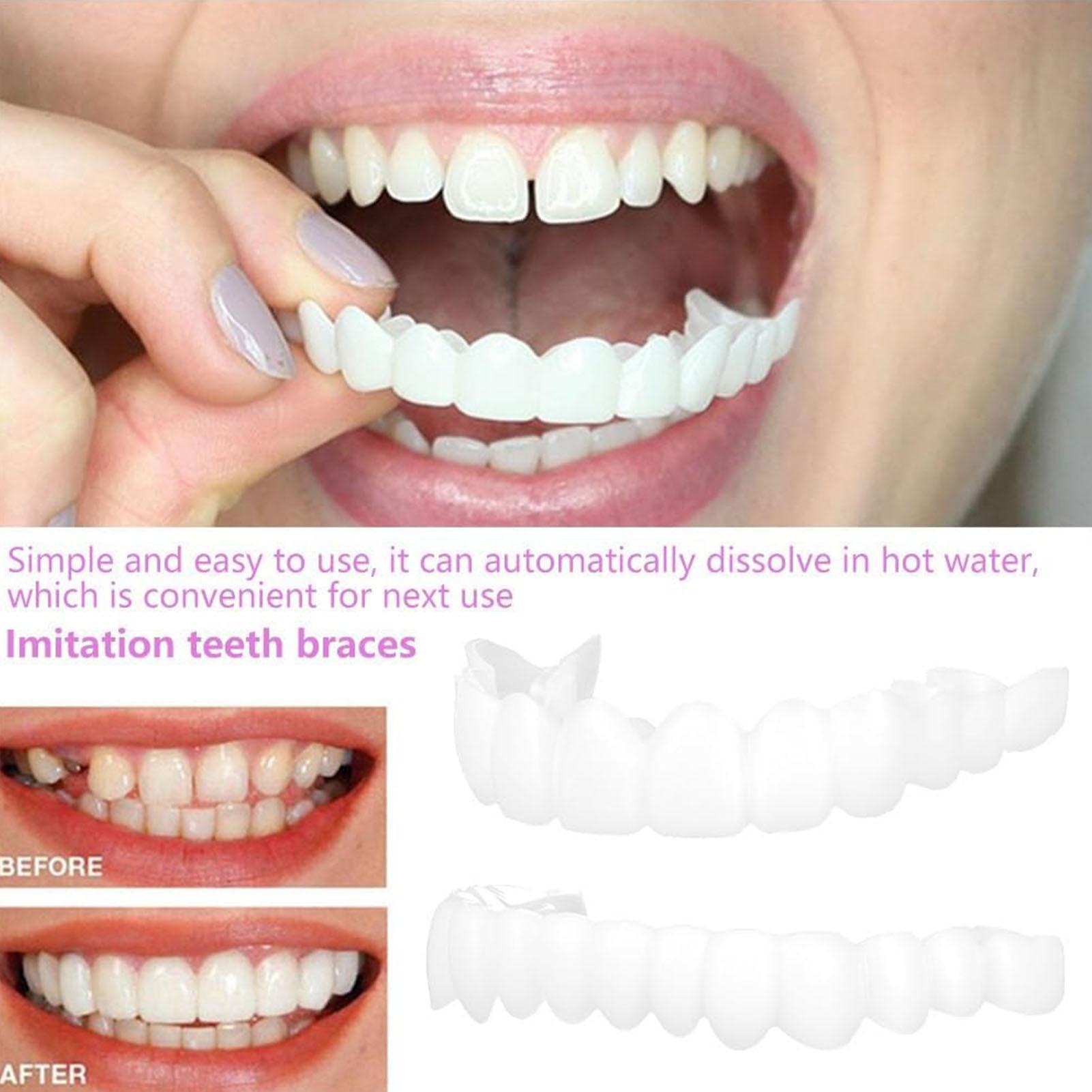 Teeth Whitening Moulds - 2 adet Erkek Kadın Geçici Diş
