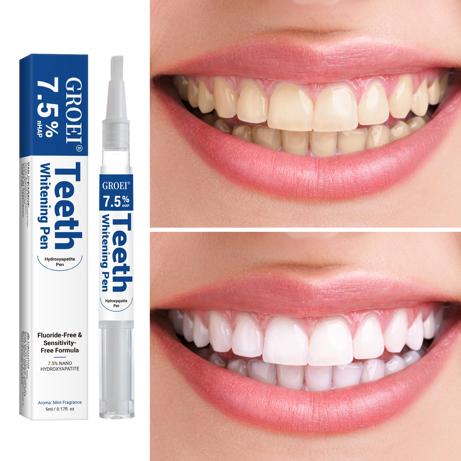 Hidroksiapatit Diş Beyazlatma  - Teeth Whitening Gels Used By Dentists incelemesi ve fiyatı