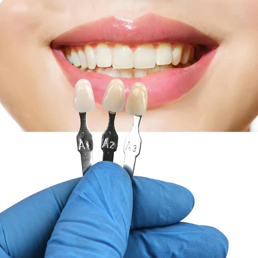 VITA 16 Renk Diş Tonu Kılavuzu - Teeth Whitening Shade Guide incelemesi ve fiyatı