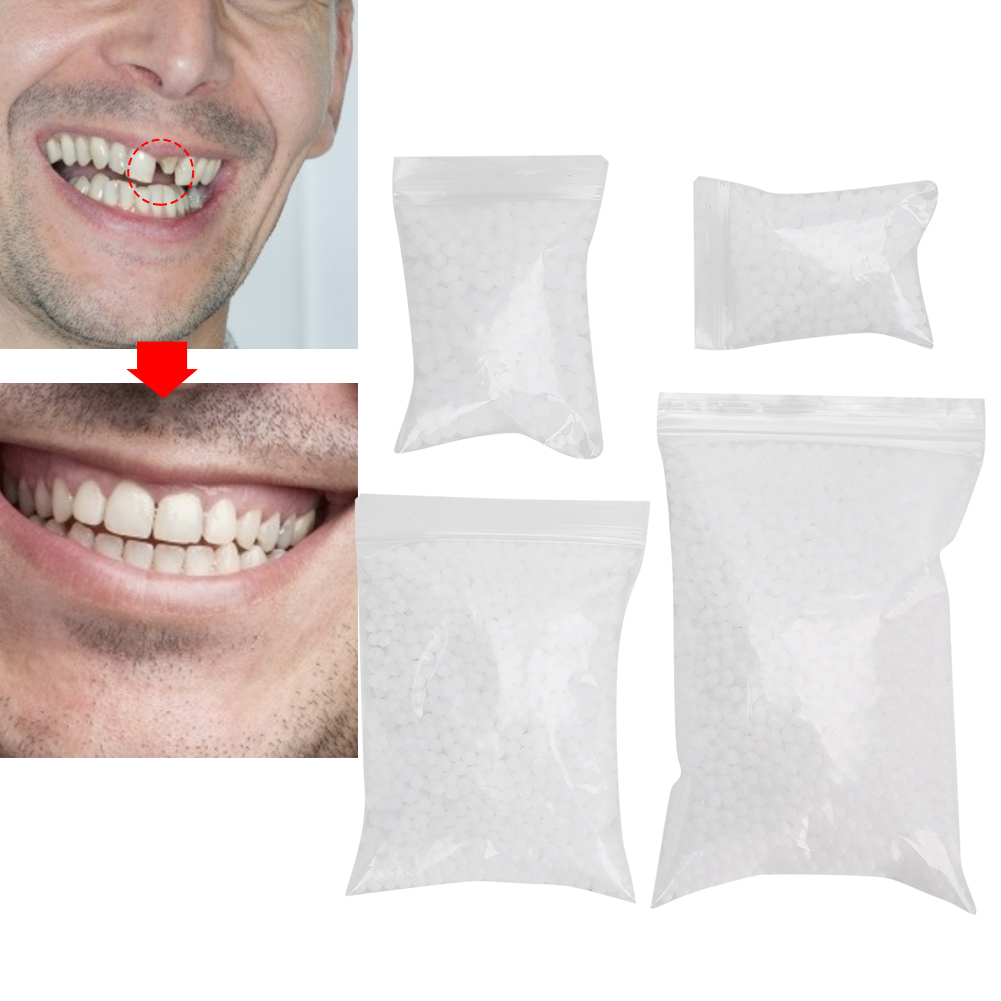 Diş Tamir Boncukları Kırık Diş - Teeth Whitening Moulds incelemesi ve fiyatı