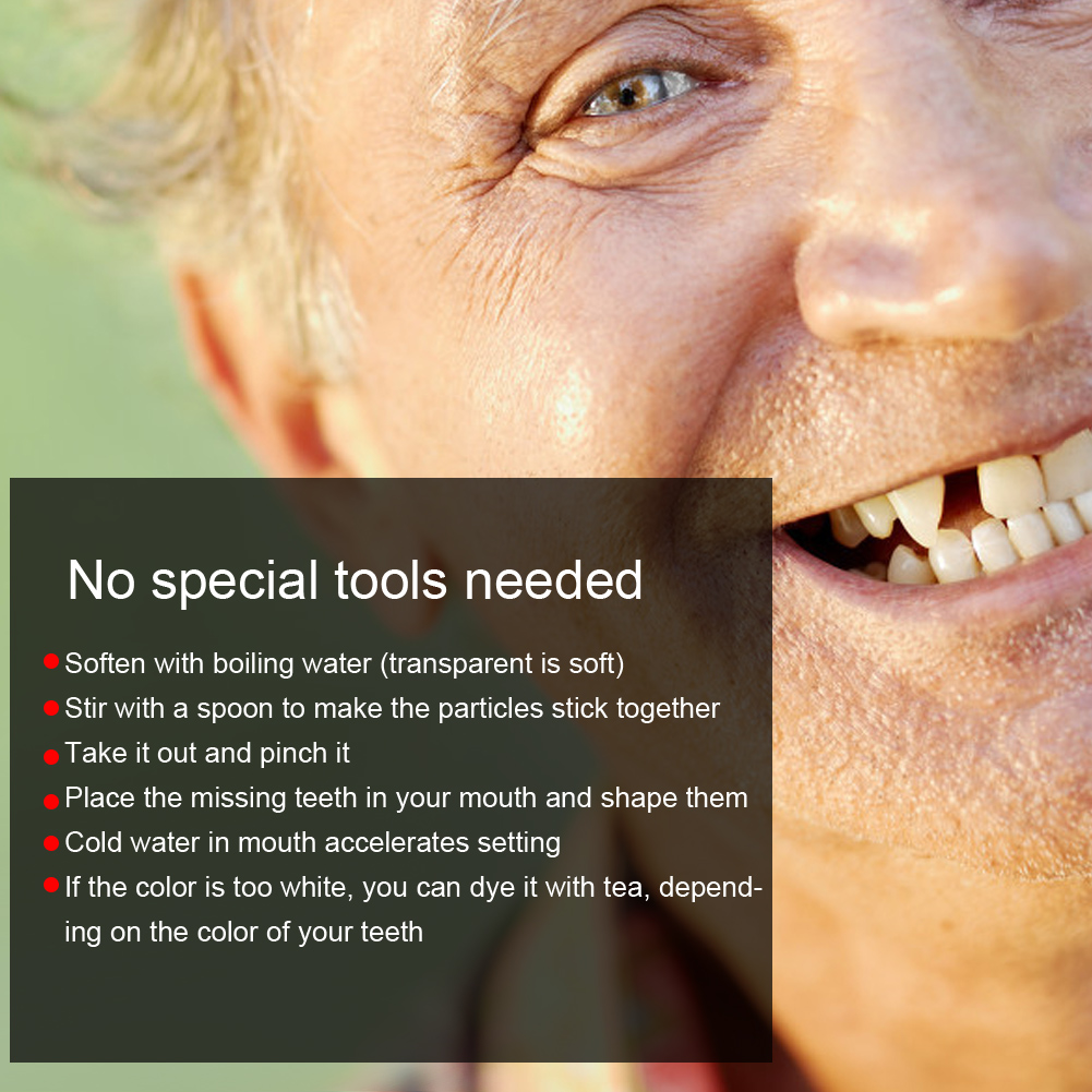 Diş Tamir Boncukları Kırık Diş - Teeth Whitening Moulds incelemesi ve fiyatı