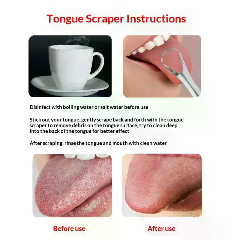 Paslanmaz Çelik Dil Kazıyıcı S - Tongue Scraper Metal incelemesi ve fiyatı