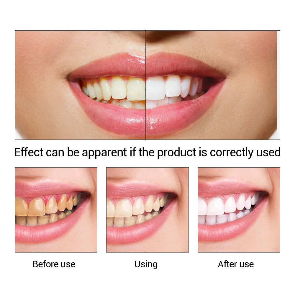 FTEENPLY diş beyazlatma özü to - Teeth Paint Whitening incelemesi ve fiyatı