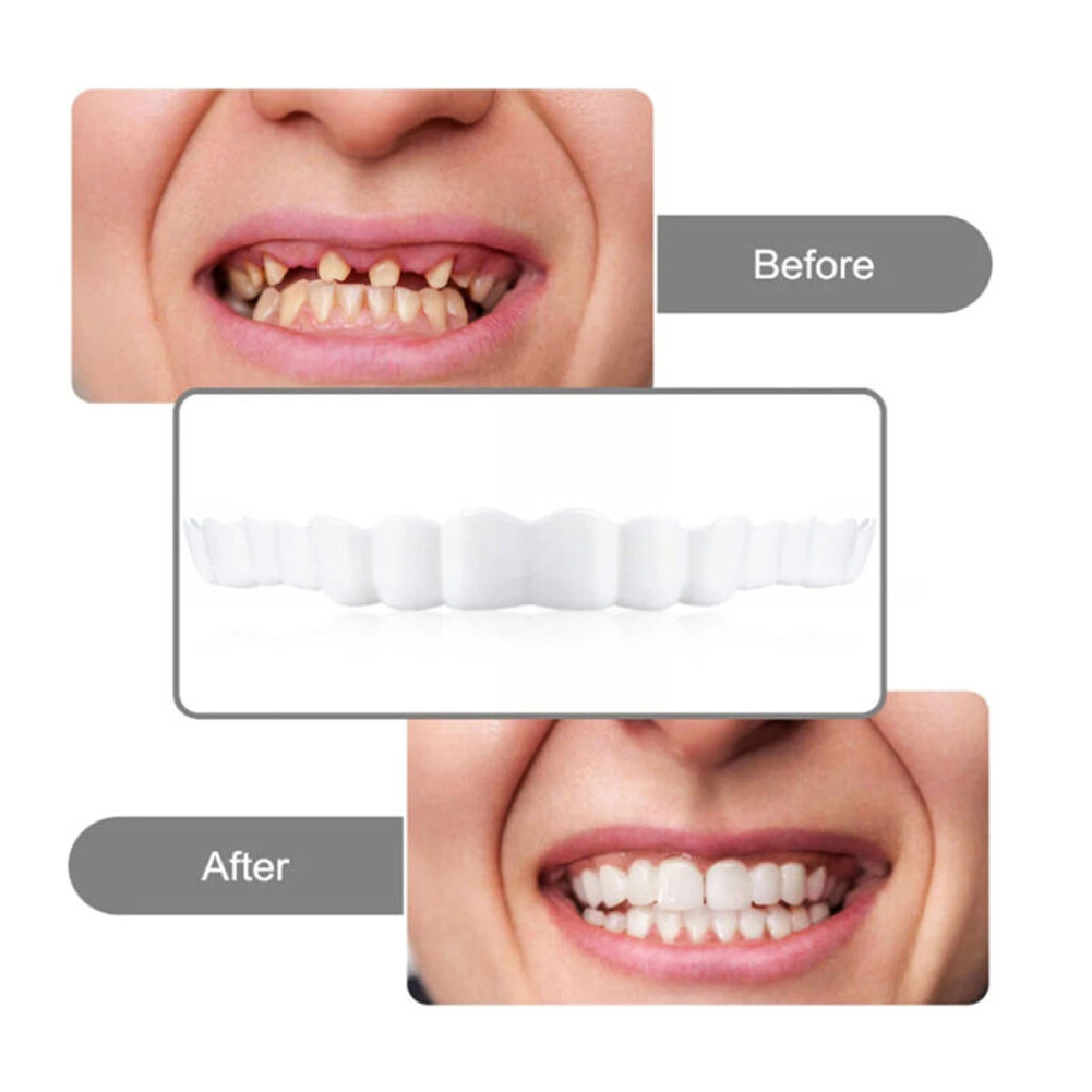 4-6 Çift Üst ve Alt Çene Prote - Teeth Whitening Moulds incelemesi ve fiyatı