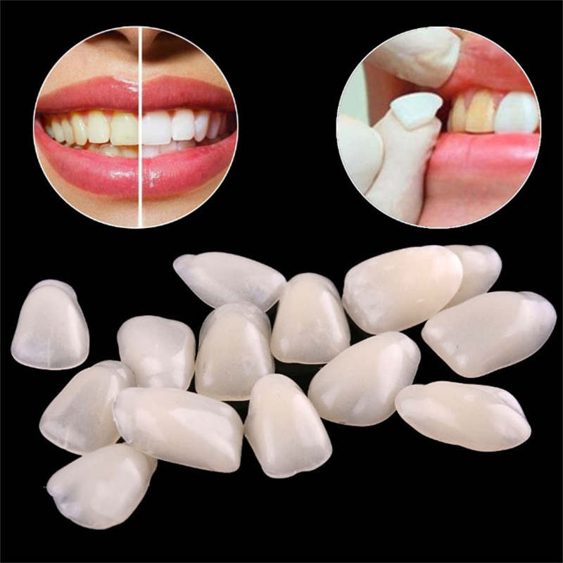 Geçici Diş Kaplamaları - Diş B - Teeth Whitening Veneers incelemesi ve fiyatı