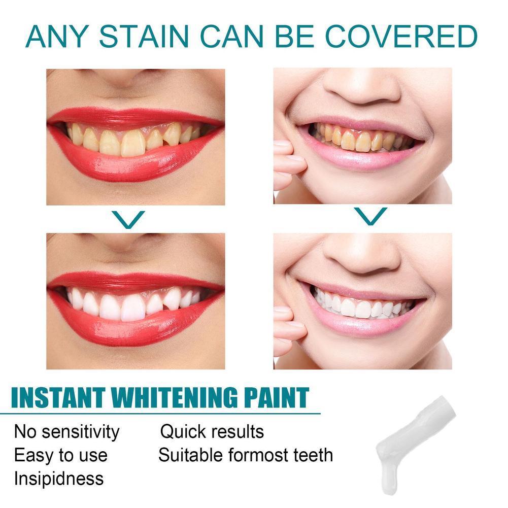 Diş Beyazlatıcı Boya Anti Pigm - Teeth Paint Whitening incelemesi ve fiyatı