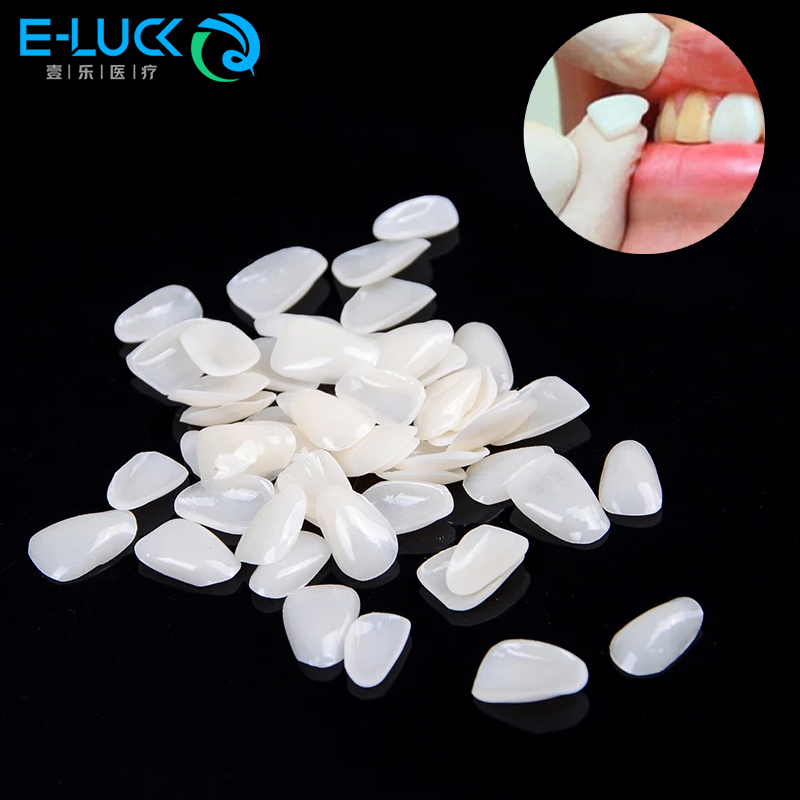 50 adet Diş Diş Kaplamaları Ge - Teeth Whitening Veneers incelemesi ve fiyatı