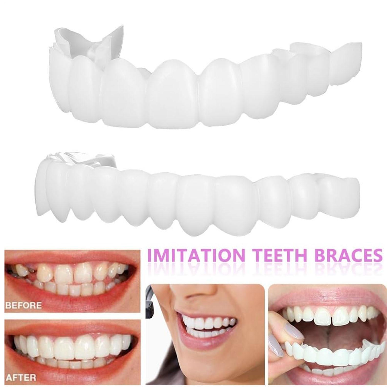 1 Çift Takma Diş Kaplaması Par - Teeth Whitening Moulds incelemesi ve fiyatı