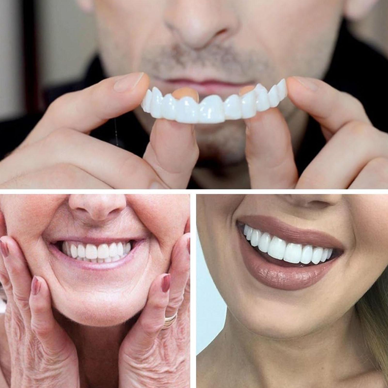 2 adet Erkek Kadın Geçici Diş  - Teeth Whitening Moulds incelemesi ve fiyatı