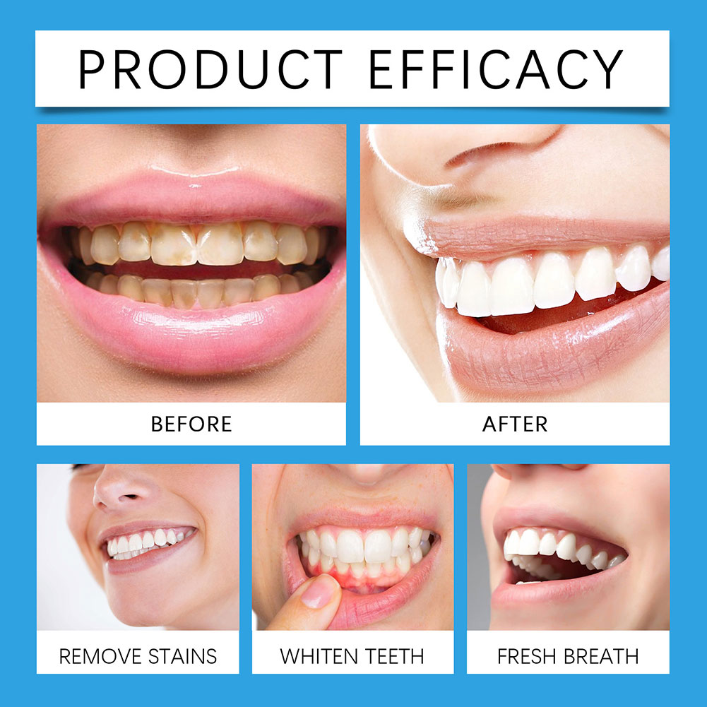 Günlük Kullanım İçin Profesyon - Teeth Whitening For Photos incelemesi ve fiyatı